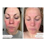 Stylpro Wavelength Masque facial LED