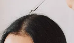 Soins du cuir chevelu